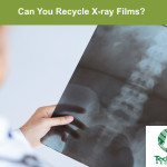 Can You Recycle X-ray Films?